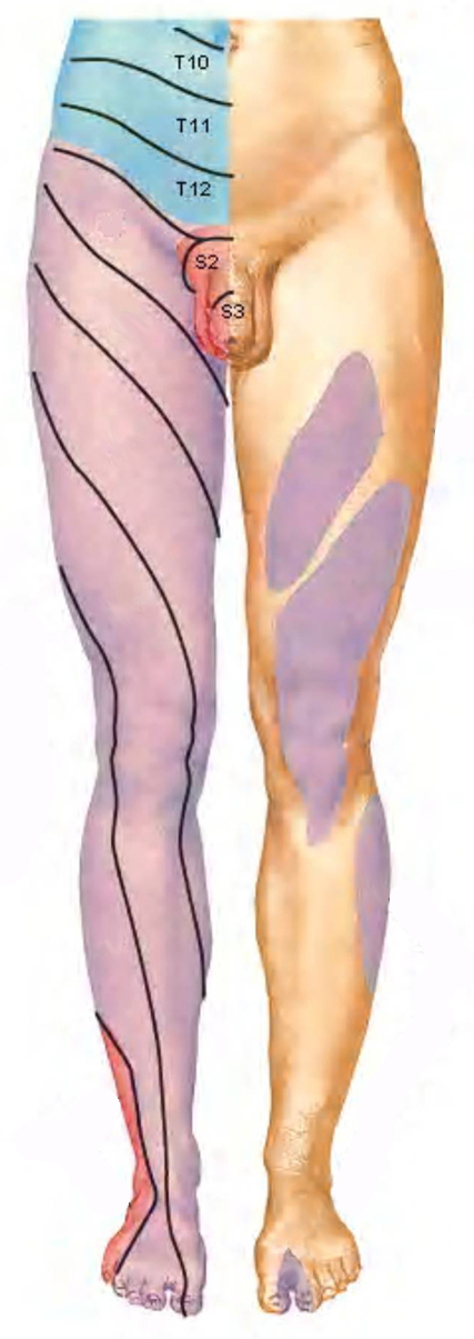 Dermatomer UE
